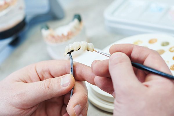 Close-up of hands adjusting dentures with tweezers at a dental lab in Hamilton, Ontario.